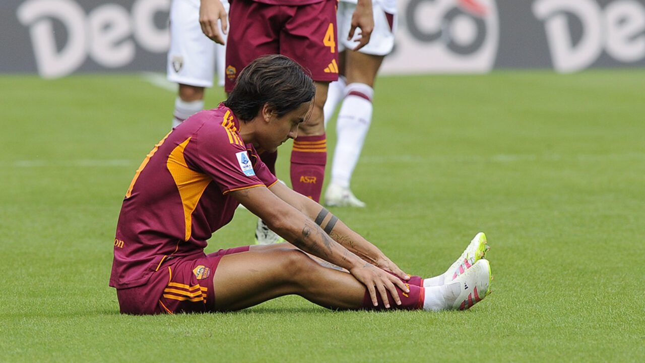 Roma, Dybala si opera al ginocchio: oggi l’intervento